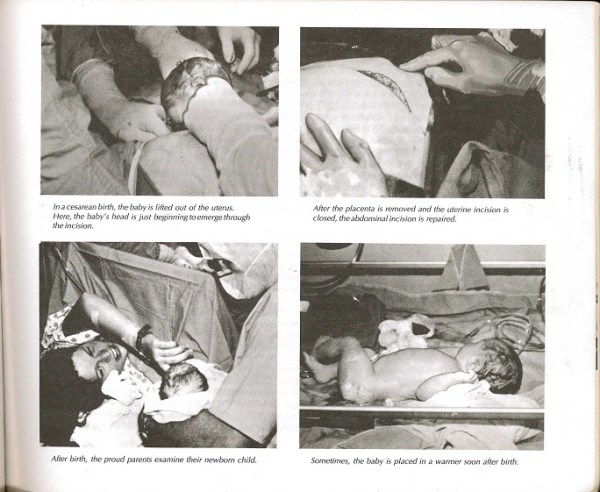 Childbirth photos