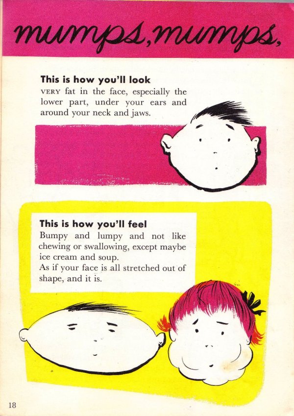 how you look with mumps