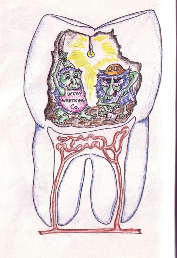 tooth diagram